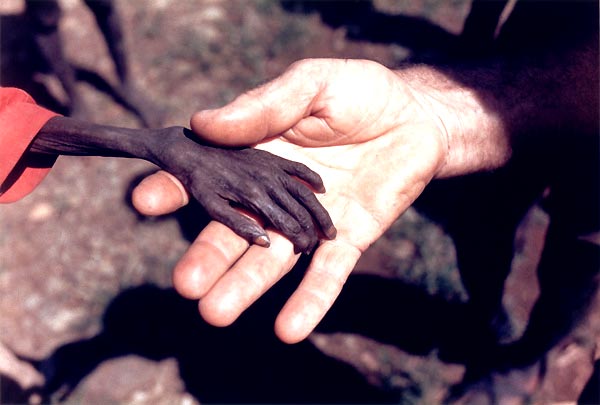 The 22 Most Heartbreaking Photography Ever! 1980 Michael Wells Ingiltere by mentor333 The 22 Most Heartbreaking Photography Ever!