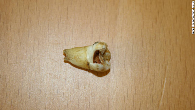 111021100635 entlennontoothauction story top pic on Design You Trust 111021100635 entlennontoothauction story top John Lennon’s tooth headed for the auction block