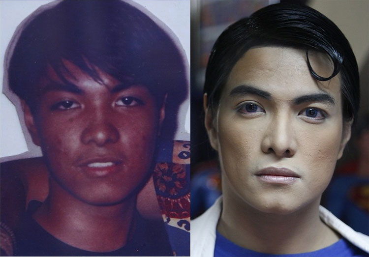 Plastic Surgery Superman: Fan Goes Under Knife to Look Like Superhero 243 Plastic Surgery Superman: Fan Goes Under Knife to Look Like Superhero