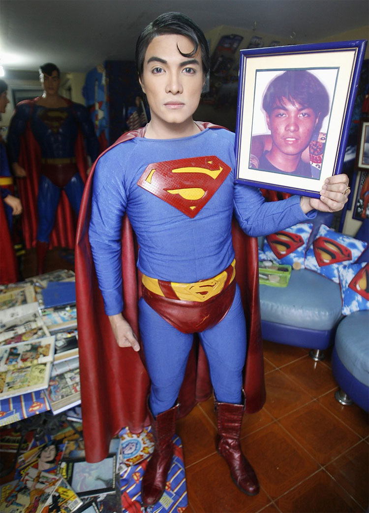 Plastic Surgery Superman: Fan Goes Under Knife to Look Like Superhero 521 Plastic Surgery Superman: Fan Goes Under Knife to Look Like Superhero