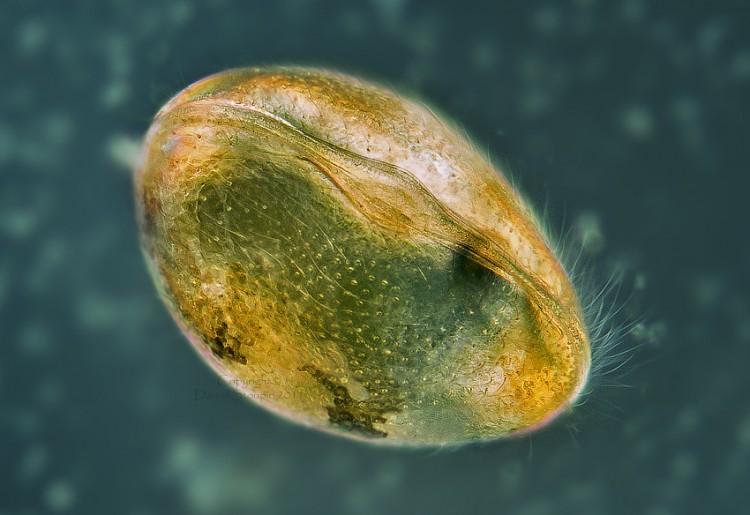 Microscopic worlds by Daniel Stoupin Ostracoda small copyright 750x515 Microscopic worlds by Daniel Stoupin
