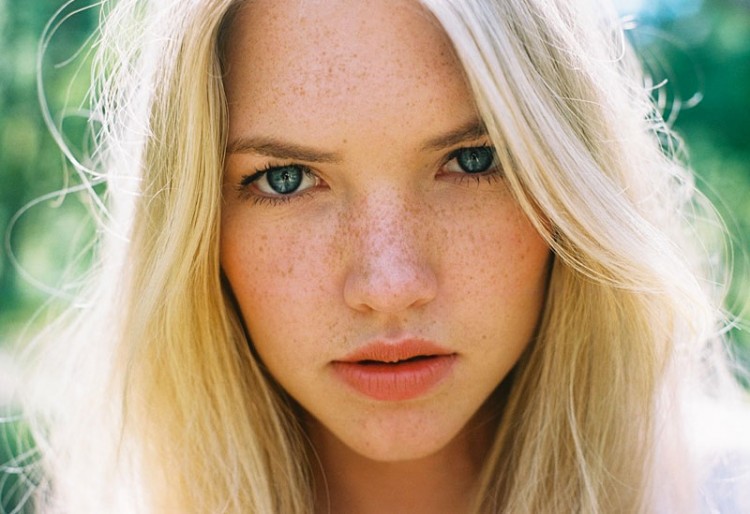 neussproet5 750x514 Beautiful girls with a freckled nose