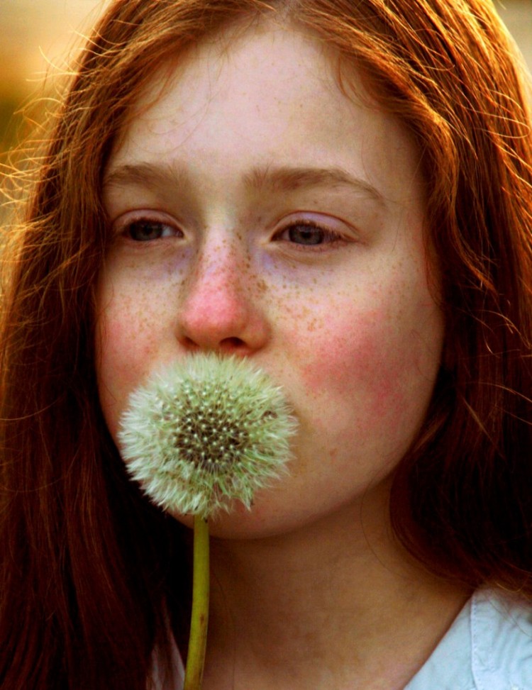 neussproet6 789x1024 750x973 Beautiful girls with a freckled nose