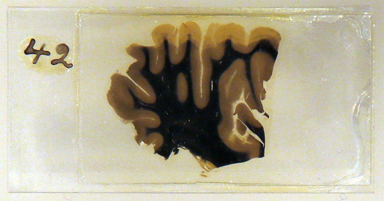 Albert Einsteins Brain on Display at London Wellcome Exhibition 298 Albert Einsteins Brain on Display at London Wellcome Exhibition