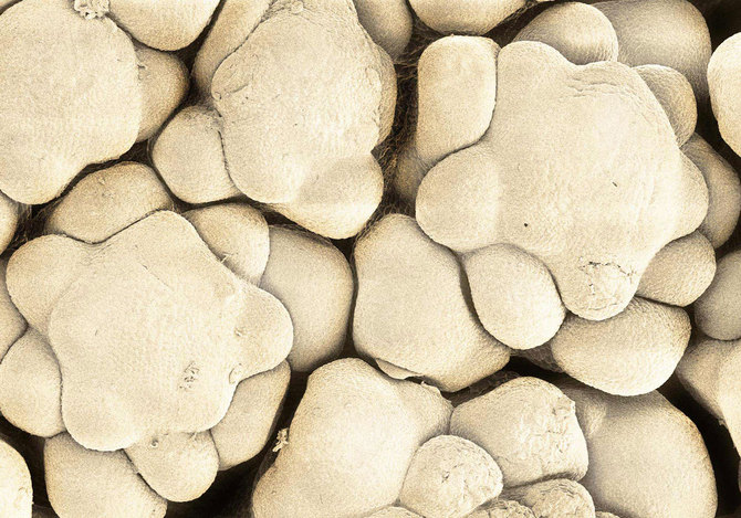 Microscopic Food Photography by Caren Alpert Caren Alpert3 Microscopic Food Photography by Caren Alpert