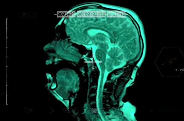  New Music Video Features MRI Scans of a Singing Head