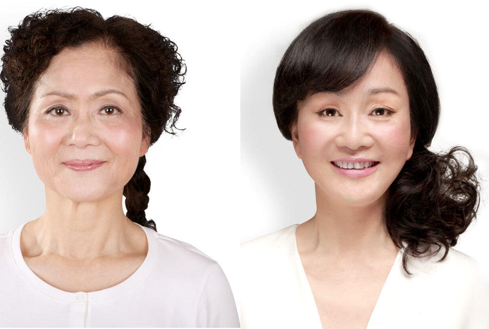 asian women plastic surgery
