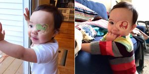 Awesome Dad Turns Daughter’s Eyepatch Into Art With Amazing Drawings