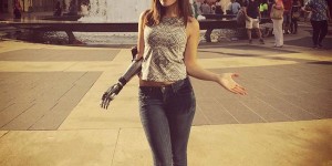 Model with Bionic Arm Will Walk the Runway at New York Fashion Week