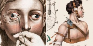 Disturbing Vintage Medical Illustrations That Will Shock You