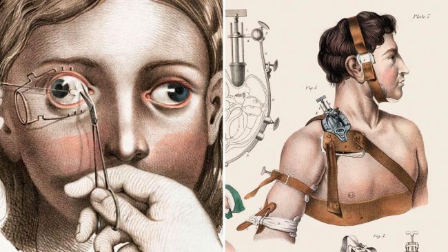 Disturbing Vintage Medical Illustrations That Will Shock You