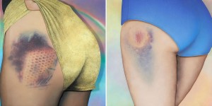 Riikka Hyvönen Captures The Beauty Of Bruises In Giant Artworks