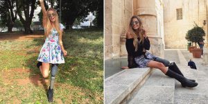 Brazilian Model Paola Antonini Inspires Fans On Instagram After Losing Leg In Car Crash