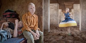 Rescue 'Fortress' In Tanzania Protects Albinos From Human Hunters
