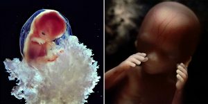 Photographer Spent 12 Years Taking Pictures Of The Foetus Developing In The Womb