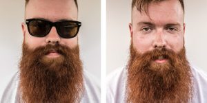 Before & After: Photographer Captures Musicians & The Toll Of Performing