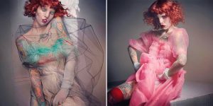 Model Born With Cat Eye Syndrome Stars In Stunning High Fashion Photo Shoot
