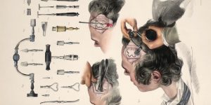 Horrifyingly Detailed NSFW Images Of Surgical Procedures From The Early 1800s