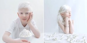 These Photos Perfectly Capture The Beauty Of People With Albinism