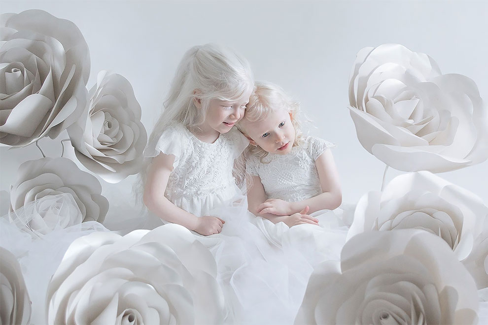 These Photos Perfectly Capture The Beauty Of People With Albinism ...
