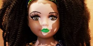 Artist Creates Dolls With Vitiligo For Kids With This Rare Skin Condition