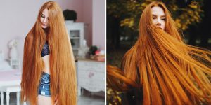 Russian Woman Who Suffered From Alopecia Now Has Beautiful Long Hair