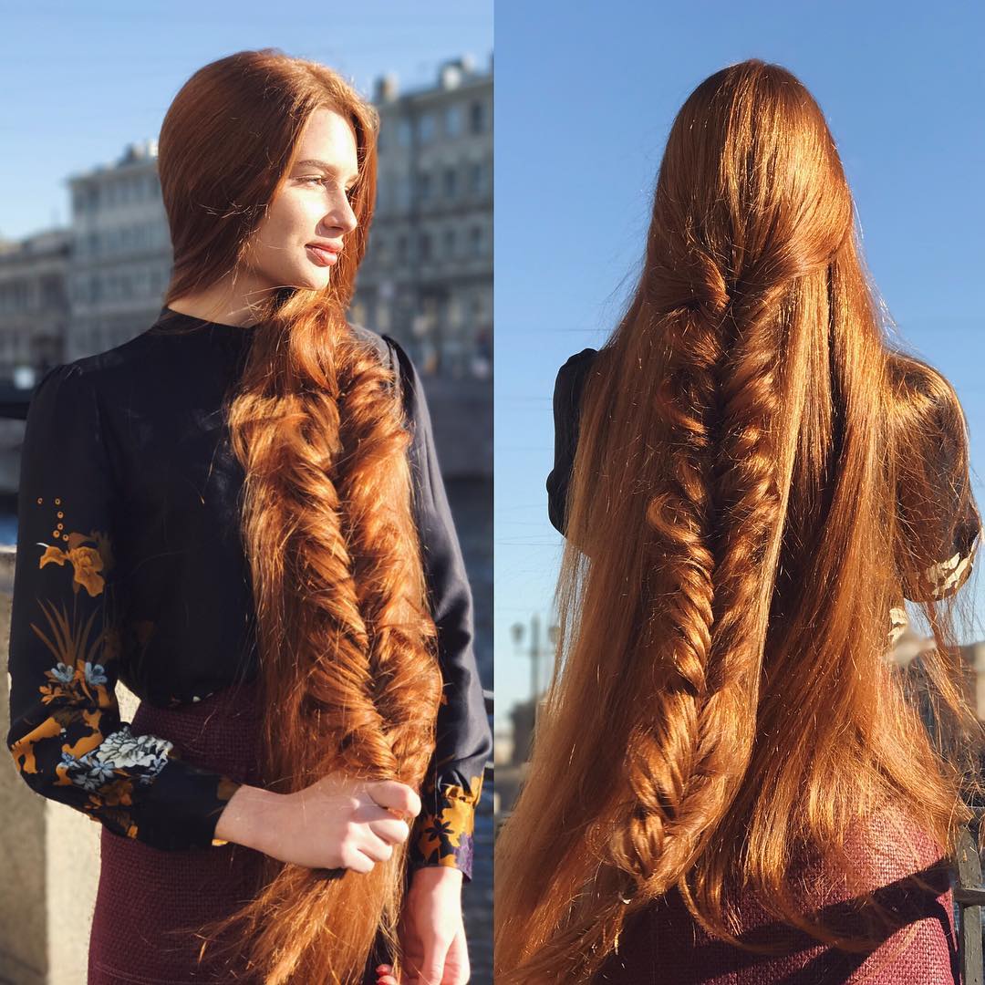 Russian Woman Who Suffered From Alopecia Now Has Beautiful