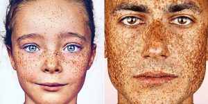 Stunning Beauty Photography Of Freckled Individuals By Brock Elbank