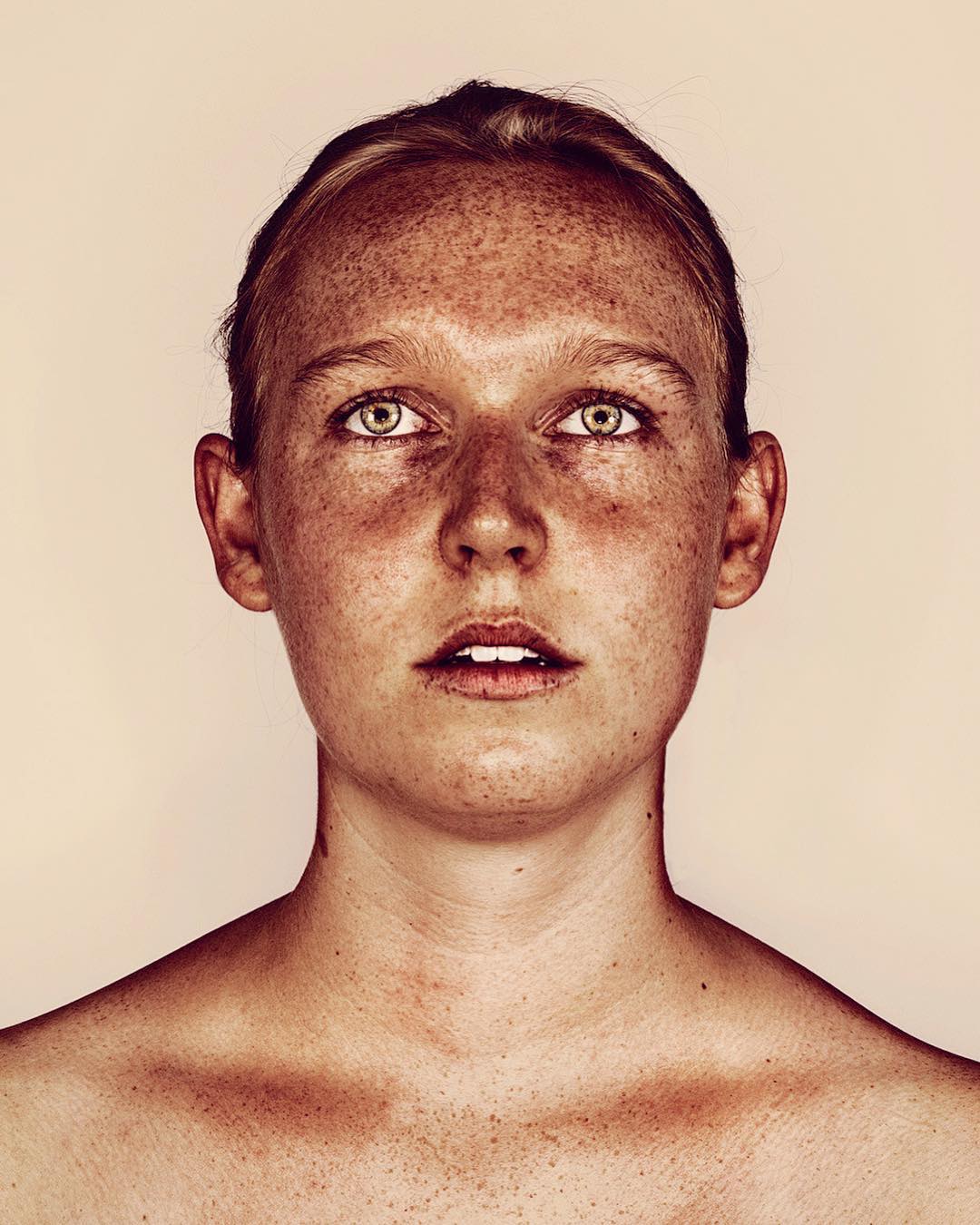 Stunning Beauty Photography Of Freckled Individuals By Brock Elbank