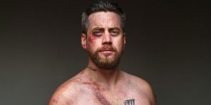 10 Car Crash Survivors Pose Proudly For A Chilling Photo Project To Raise Awareness About Seatbelt Safety