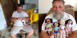 Grandfather With Vitiligo Crochets Dolls To Make Children With This Condition Feel Better
