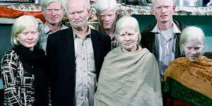 Fascinating Photographs Of The World's Biggest Albino Family