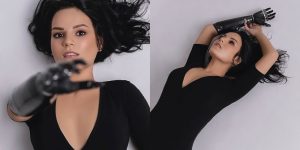 Rita – The Girl Who Happily Lives With A Bionical Hand