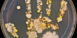 Microbes On 8-Year-Old Boy’s Handprint After Playing Outside