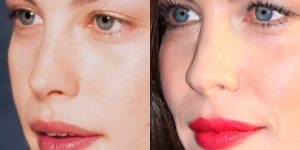 This Instagram Account Points Out How Much Celebrity Faces Have Changed Over The Years
