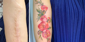 Vietnamese Tattoo Artist Masks People’s Scars With Beautiful Artworks