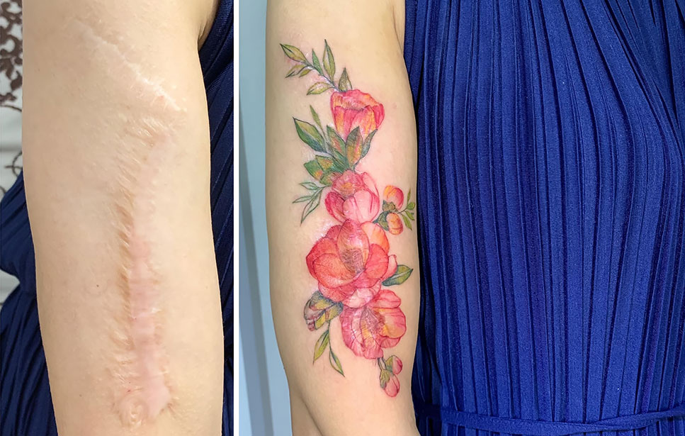 Vietnamese Tattoo Artist Masks People’s Scars With Beautiful Artworks