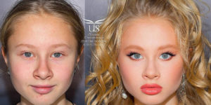 Before & After Pics Of Clients By This Makeup Artist From St. Petersburg