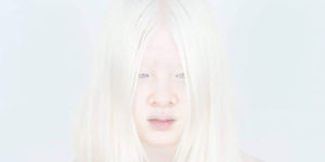 Abandoned As A Baby Due To Albinism, Xueli Grew Up To Become A Vogue Model