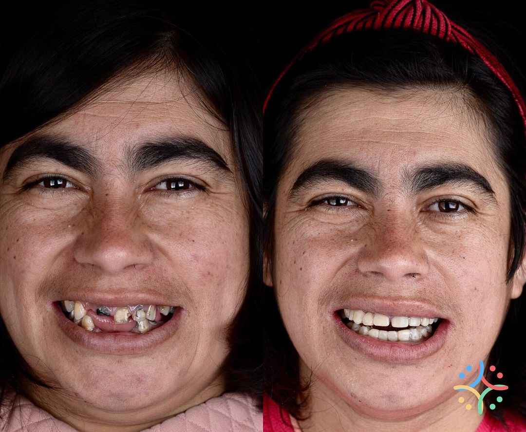 Brazilian Dentist Felipe Rossi Treat The Teeth Of Poor People - Vimarsana News