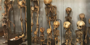 This Man Has a Damn Creepy Collection of Anatomical Exhibits