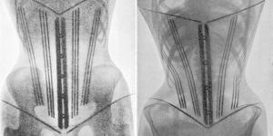 In 1908, a Doctor Used X-Rays to Highlight the Damaging Effects of Tight Corsets on a Woman’s Body