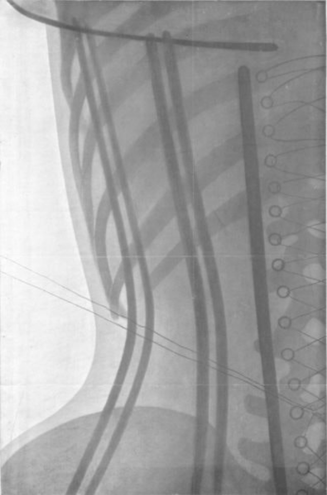 corset-x-rays-of-dr-ludovic-o-followell-5