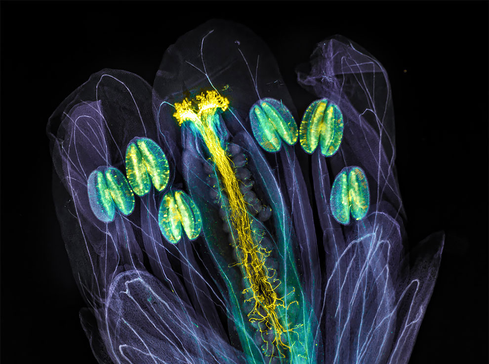 The Art of Science: Olympus Image of The Year Award Announce Its Winners for 2021 - Vimarsana News