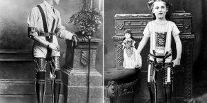 The Gepetto of Prosthetic Limbs: These Early Prostheses Made by James Gillingham From 1900 Were Decades Ahead of Time