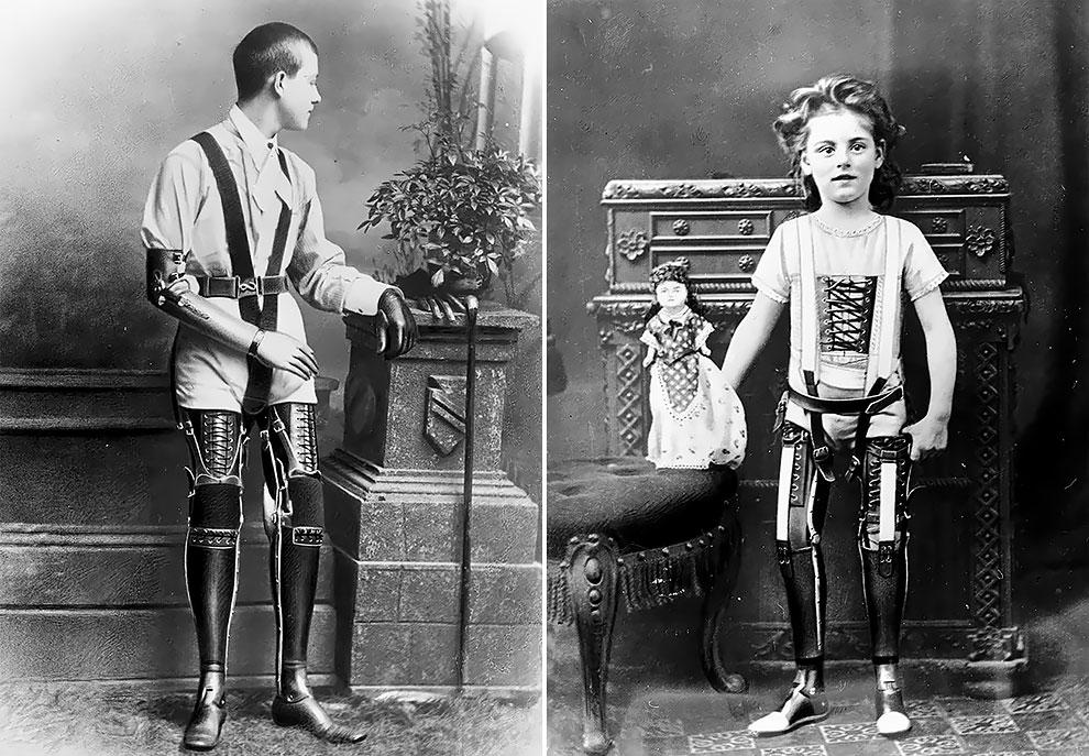 The Gepetto of Prosthetic Limbs: These Early Prostheses Made by James ...