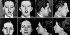 Stunning Examples of the Rhinoplasty Surgery from the 1920s and 1930s