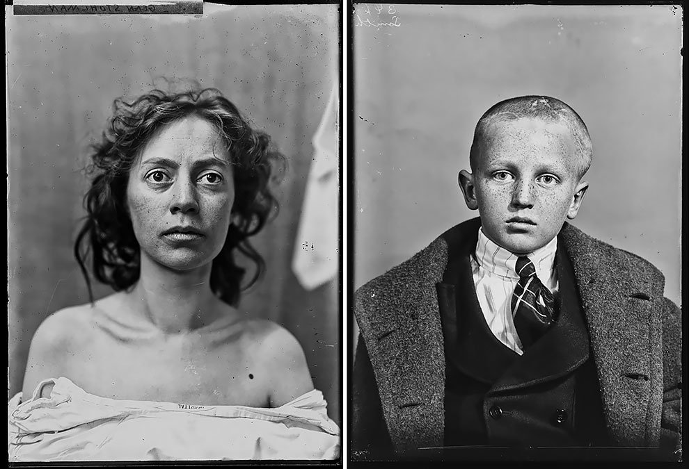 Early-20th-Century Haunting Portraits of Dr. Harvey Cushing’s Surgery ...