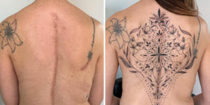 This brazilian tattoo artist turns scars into art 67dadc8323eb6 700