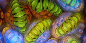 Amazing Winners of the 2025 Nikon Small World Photomicrography Competition